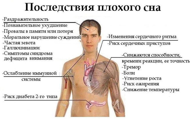 Последствия плохого сна